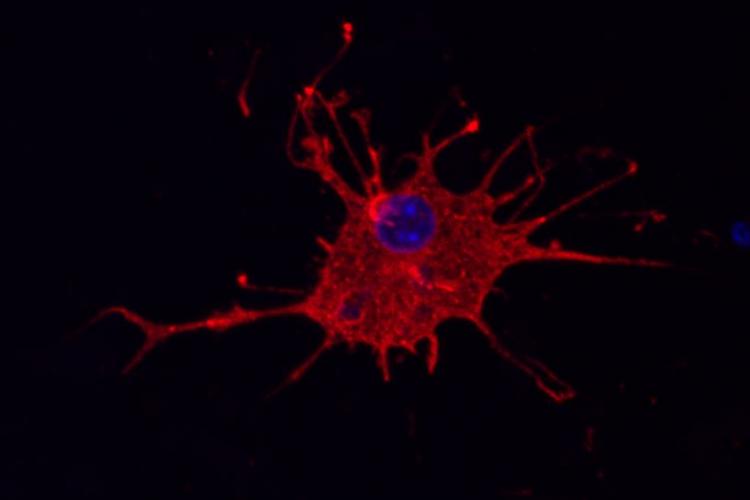 Human microglia. Image c Life &amp; Brain