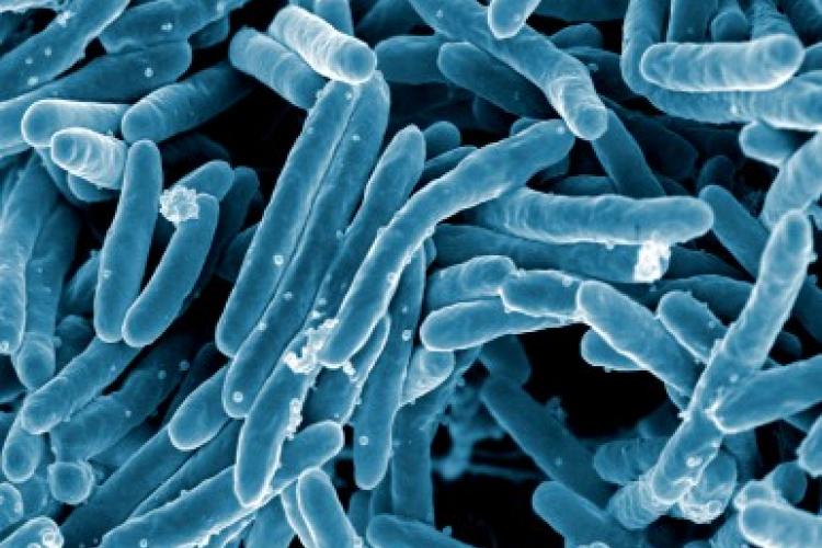 TB bacteria, credit NIAID / NIH