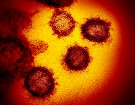 SARS-CoV-2 virus. Image credit: National Institute of Allergy and Infectious Diseases-Rocky Mountain Laboratories, NIH