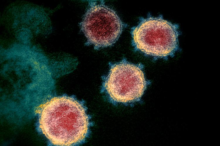 The SARS-CoV-2 virus. Credit NIAID-RML