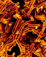 Mycobacterium tuberculosis, the bacterium that causes TB. Image by National Institute of Allergy and Infectious Diseases, National Institutes of Health