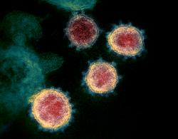 The SARS-CoV-2 virus. Credit NIAID-RML